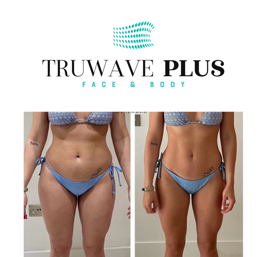 The Complete Guide to Professional Electro Muscle Stimulation Equipment for Spas and Clinics